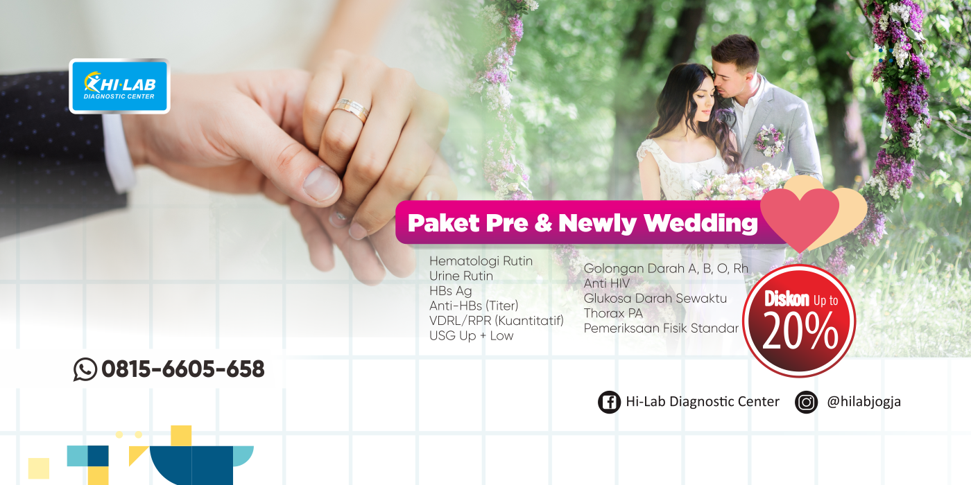 Promo Oktober - Paket Pre & Newly Wedding